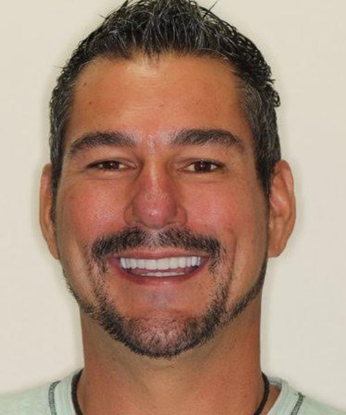 Best Dentists Lindale - Tyler TX - Center for Implants & General Dentistry