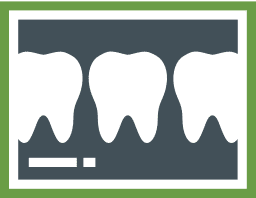 Best Dental Care Near You in Lindale - Tyler TX - Top Dentists Lindale, Tyler TX - Center for Implants & General Dentistry