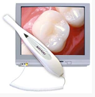 Why You Want Your Dentist Using Intraoral Cameras