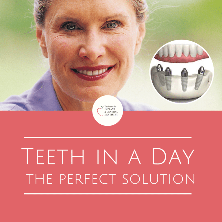 Teeth in a Day in Lindale, TX