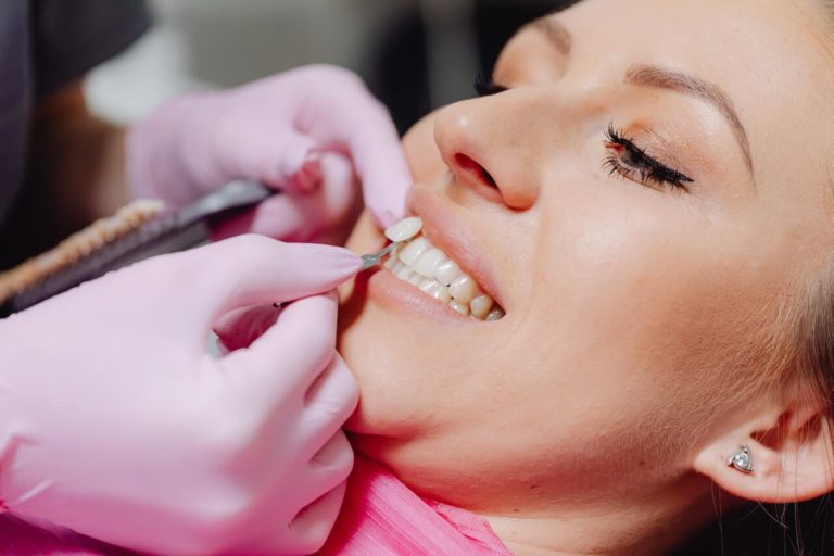 What Types of Dental Problems Cannot Be Fixed with Dental Veneers?